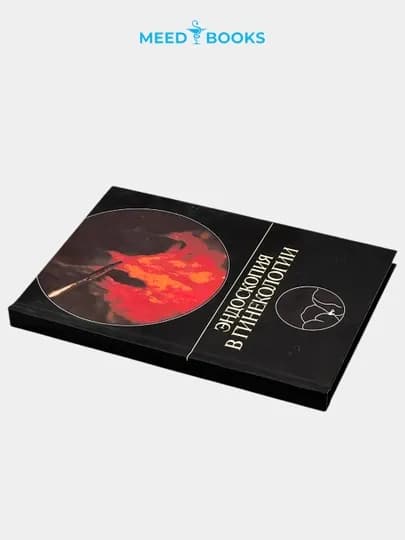 Эндоскопия в гинекологии. Мед книга