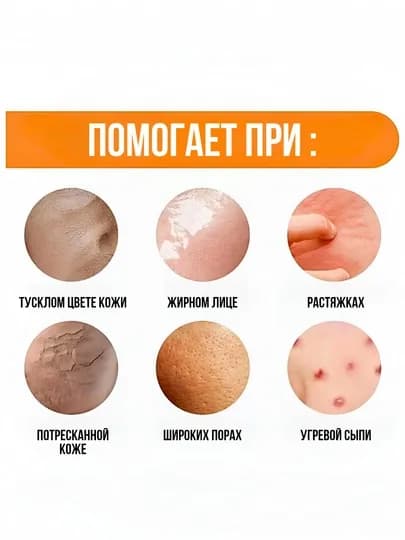 Отбеливающее мыло для лица и тела с витамином С, очищает кожу от чёрных точек и камедонов